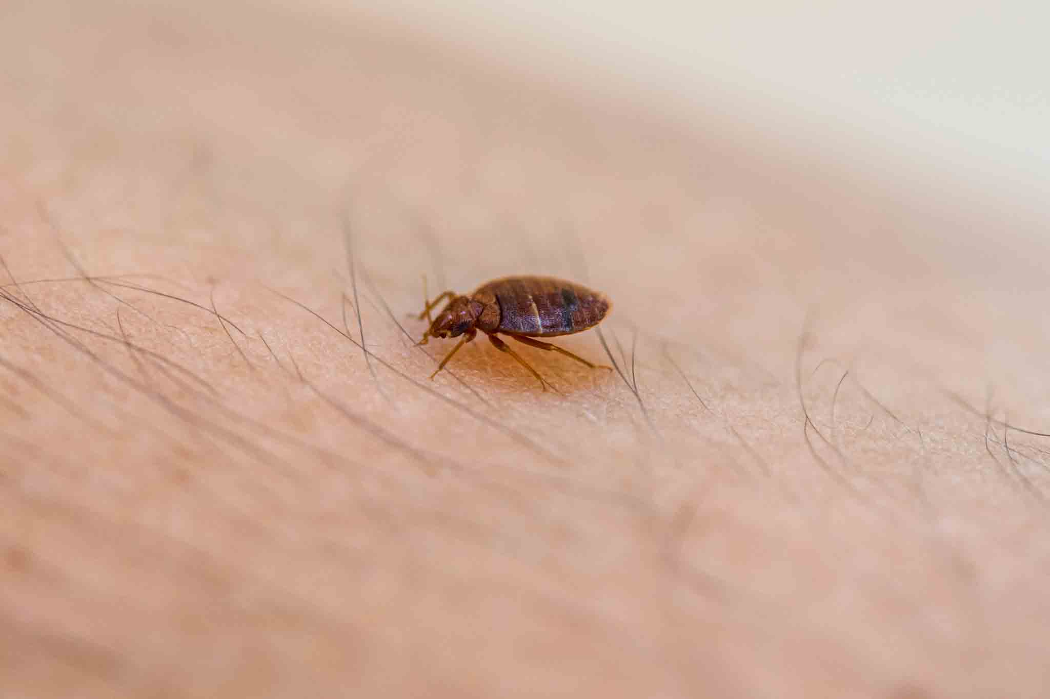 A bed bug sitting on an arm, choose Hello Pest Control Westchester County for pest control.