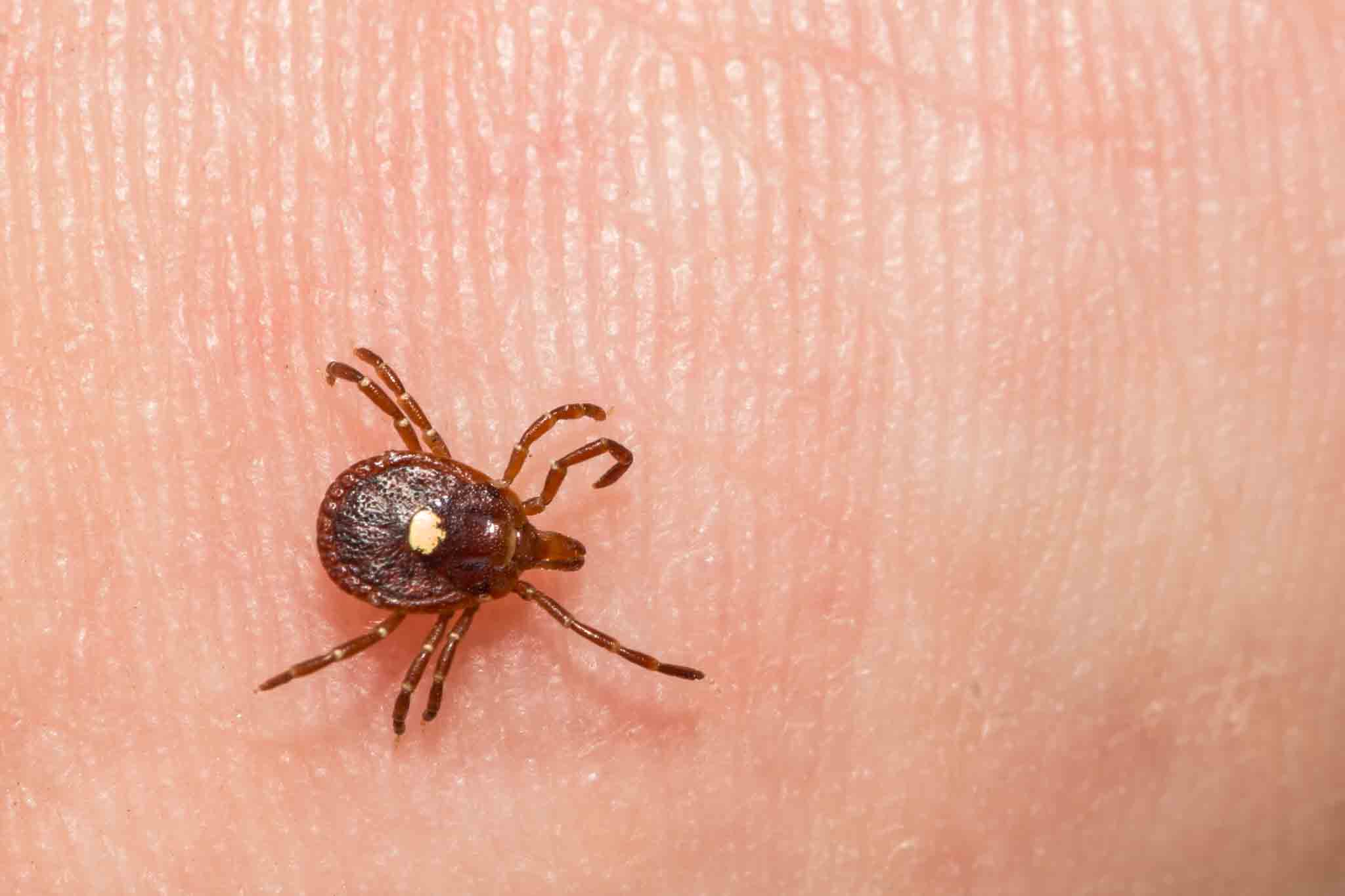 A brown tick on a human hand, choose Hello Pest Control Westchester County services.